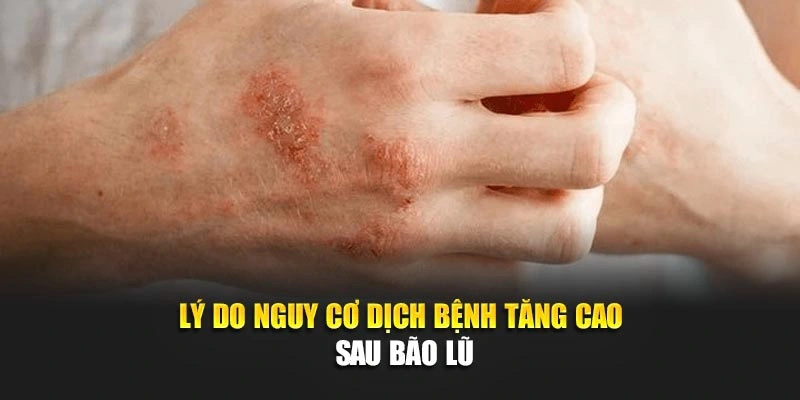 L&yacute; do nguy cơ dịch bệnh tăng cao sau b&atilde;o lũ